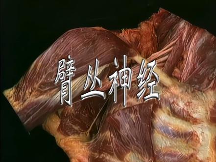 艾氏解剖|01上肢9|臂丛神经 #艾氏解剖 #大体老师