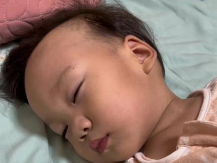 #急性喉炎 还分不清急性喉炎的妈妈可以听听这个声音!视频拍摄于几天前,晚上十一点突然听到儿子睡着呼噜呼噜的声音,当时以为是鼻塞有鼻💩,拿手机灯照了照确定没有,老公还一直说可能是鼻子深部有看不到,没一会就发现他呼吸困难 ,突然想到刷抖音刷到的急性喉炎,赶紧对老公说我们马上去医院,去医院的路上孩子已经有点缺yang了,张着嘴睡觉,憋闷的厉害,(此时内心特别煎熬,手一直发抖)到了儿童医院急诊科 ,接诊护士看了看情况说不用挂号赶紧找衣生,🧑⚕️看了看喉咙说喉头水肿,判断为急性喉炎,赶紧给打了一针地塞米松,紧接着又做了两次雾化,做完治疗孩子情况也慢慢好了很多,让回家观察 ,(期间不放心反复问了好几次衣生,回到家不会再憋闷了吧,实在是害怕,衣生说用完激素💊了不会)
回到家不放心又查阅了急性喉炎的相关资料,越看越害怕,也无比庆幸自己在不确定孩子怎么了的情况下迅速去了🏥,急性喉炎起病急,进展快,严重时会造成喉梗阻引起窒息!希望刷到视频的父母看到类似的情况也能引起重视,也希望所有的孩子都健健康康平平安安成长#健康成长