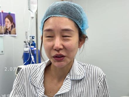 5分钟带你体验2.0联合抗衰全过程 个人效果差异,出镜人已签署相关肖像授权,此视频不宣导任何风险医疗项目!出镜人已满25周岁!#面部提升三件套#法令纹怎么消除#面部提升#抗衰老#变美