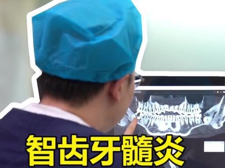 如果智齿蛀牙疼痛难忍,可能已经牙髓发炎,应该怎么处理呢?#智齿 #口腔科刘博闻 @抖音小助手