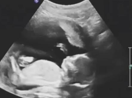 #创作灵感 奇怪!羊水为什么叫“羊水”,而不是叫“人水”、“牛水”? #羊水 #胎儿 #母婴知识