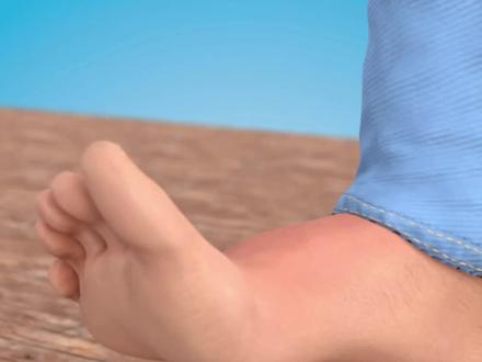 被木刺扎怕了?试试这个无痛取刺黑科技,一吸就掉!