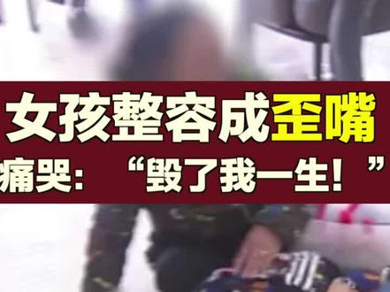 【#女孩整容成歪嘴痛哭:“毁了我一生!”】这到底是整容还是毁容?! #整容