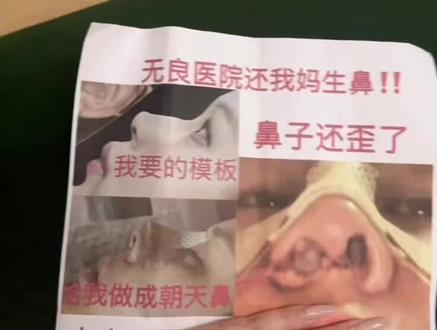 还我妈生脸#整容 #整容失败 #变美 #维权 #认知