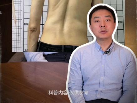 脊柱侧弯的危害到底有多大? #脊柱侧弯