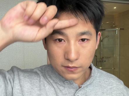 拯救山羊角计划-蔓迪米诺地尔泡沫三个月开始打卡#实测 #蔓迪米诺地尔酊