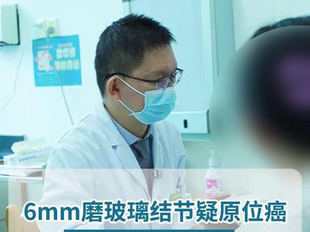 6mm磨玻璃结节疑原位癌,到底切还是等? #磨玻璃结节 #原位癌 #胸外科