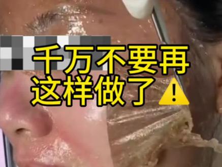 剥脱项目,是不是还有人在做#黄褐斑 #七天揭膜 #577#美白淡斑#护肤