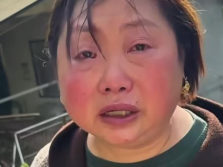 全网“力挺”向金元,吹毛求疵的人可以闭嘴了! 村干部向金元,戴个金色耳环被喷了。随后,不仅各大权威媒体站出来支持向金元,广大网友也纷纷自发抵制恶意杂音!向金元,为何得到全网力挺?答案很简单,我们要为奋战在抗灾救灾一线的干部撑腰,绝不能让那些聒噪、无脑的言语寒了实干者的心!基层干部有爱美之心、注重个人仪容,这与危急关头挺身而出、冲锋在前,从来都不是对立的。眼下灾情还未平息,救灾任务繁重又紧急,一线干部群众根本经不起这种毫无意义的精神耗损。多一份理解,少一份苛责,用心守护每一份挺身而出的责任,才能让基层干部放下顾虑、安心前行,守护好群众的家园!那些对着细枝末节吹毛求疵的人,可以闭嘴了!#媒体精选计划