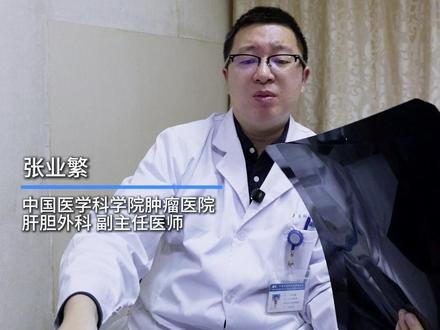 异常性增生结节是癌吗?需要手术吗? #dn结节 #肝硬化结节 #肝癌 #中国医学科学院肿瘤医院