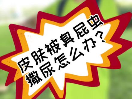 皮肤被臭屁虫撒尿怎么办?#防虫小妙招 #小妙招大作用 #驱虫的妙招 #蚊虫叮咬 #生活常识
