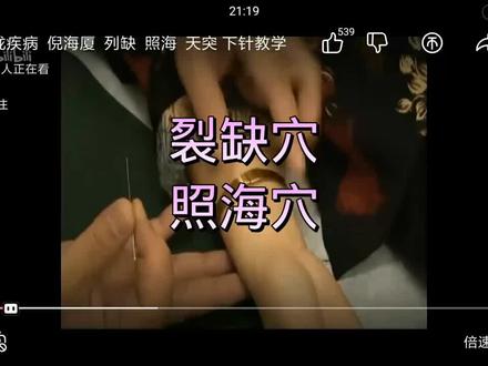 裂缺,照海穴#中医手法