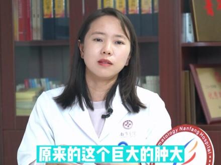 当你右侧卧时,肚脐左边摸到个硬肿块,这很可能是脾脏肿大。此时该怎么办呢?和白血病有什么关系?什么原因导致了脾脏肿大?很严重吗?听听南方医院MPN亚专科许娜医生怎么讲~#医学科普#医学常识#南方医院#血液科#在自己的专科领域可以有多牛#感染性脾脏肿大#慢性粒细胞白血病#骨髓增殖性肿瘤#巨脾#白血病#守护健康#希望能帮到有需要的人