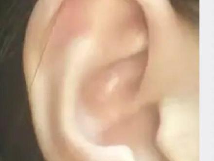 识人篇:耳相九讲,贴脑耳鸡嘴耳如何自我认识和调整 识人篇:耳相九讲,贴脑耳鸡嘴耳如何自我认识和调整#面相#识人术#职场#心理学#弘扬和传承民俗文化