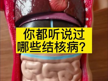 结核病都可以发生在什么部位?#人体器官内脏位置图 #肺结核#肾结核#结核病误诊 #方医生