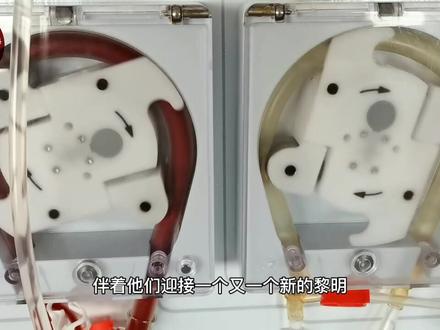 今天带大家看血透中心的一天