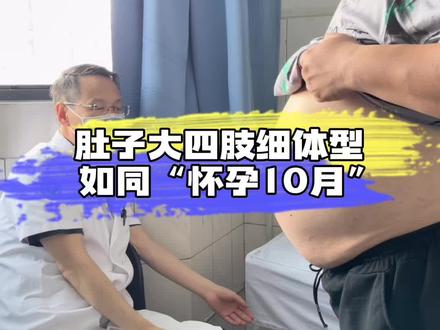 #肥胖 一起看看来面诊胖友的#大肚子
