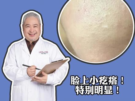 光打到脸上,看到一颗颗的小疹子,这是逆光疹吗?#医学科普 #皮肤