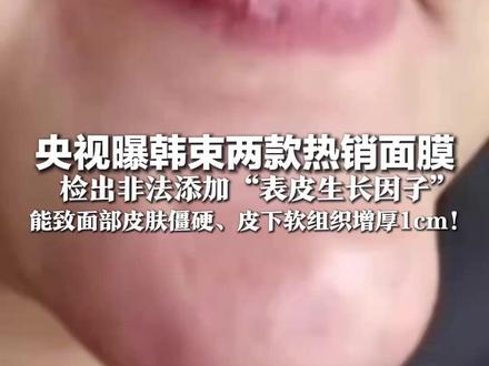 央视曝韩束两款热销面膜 检出非法添加“表皮生长因子” 有人使用含此成分护肤品 致面部皮肤僵硬、皮下软组织增厚1cm!