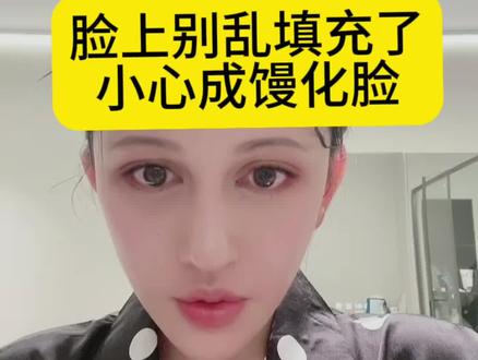 已经有很多人被脸上填充这些乱七八糟害了~希望更多女孩子别在被骗了…#日常唠嗑 #整容需谨慎 #干货分享 #说点大实话 #女生必看