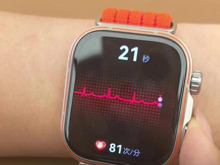 #华为WATCHFIT5 Pro全新重点升级的两个功能实测。
#智能手表#运动健康#HarmonyOS6