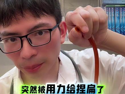 哮喘和慢阻肺到底有什么区别?很多人把哮喘和慢阻肺搞混,其实他们不是一回事!
哮喘年轻的时候就会发作
大多数慢阻肺病一般50岁以后发病,一个是“一阵一阵的”,一个是“长期堵”。
听我用水管的比喻,一讲就明白,别再自己乱猜啦。
有问题及时去检查
记得收藏转给家里人,一定用得上!
#哮喘 #慢阻肺#copd#抖出健康知识宝藏#健康科普
Many people mix up asthma and COPD, but they’re not the same!
One comes and goes, the other blocks your lungs all the time.
Listen to my “water pipe” example — you’ll get it right away.
If you feel short of breath, go see a doctor early!
Save and share this with your family — it’s really useful!