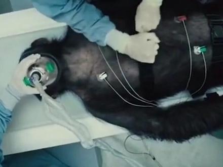 人能移植动物心脏吗?成功移植“狒狒心脏”的女婴,最后活了多久?#科学科普 #心脏移植 #狒狒心脏 #寿命