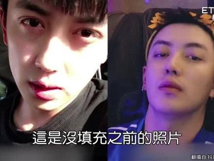 容貌焦虑?对颜值要求更高?长得丑与美都不重要,重要的是健康!可惜了