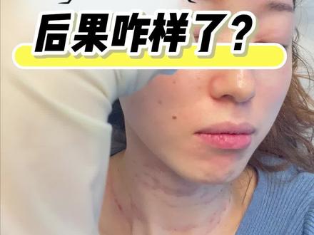 40岁普通打工族花10个w告诉你医美到最后的结果#医美 #避坑指南 #医美的尽头是什么 #抗衰老逆龄去皱纹