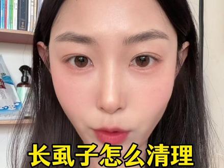 你们别问我怎么清理的了,就是这样,不想再回忆了🙄#头虱子 #无语事件