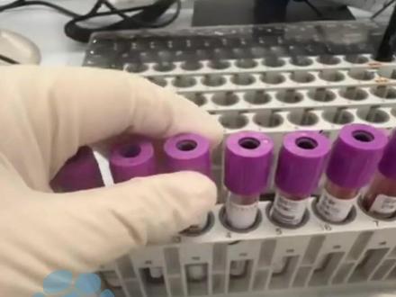 广西发现罕见血型“恐龙血”,比熊猫血还稀有,全球仅两例报道,确认血型由基因突变导致,医生:建议定期献血,将自己血液储存起来 以备不时之需#大象主播说