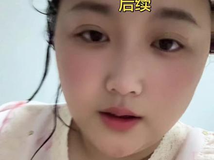 因为她没啥症状平时
这次看检查出来我们是懵懵的#减肥