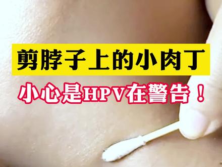 女生害怕的皮肤病,教你在家这样处理 #咪喹莫特乳膏 #hpv#丝状疣 #科普
