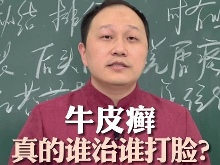 牛皮癣,真的谁治谁打脸?说到底就是一个“燥”字 #牛皮癣 #血燥 #中医 #中医杨哲 #银屑病