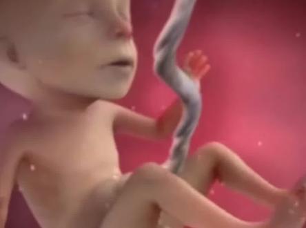 脐带血到底有没有必要存,看完至少省2万!#脐带血 #脐带血储存 #孕期知识 #育儿经验分享