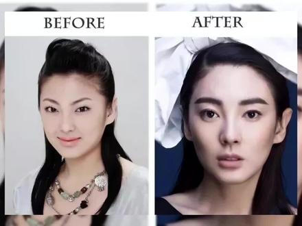 原来他们的双眼皮都是割的#整容前后 #成龙 #张雨绮 #戚薇 #张彬彬 #郭敬明 #陈数 #傅菁 #金城武