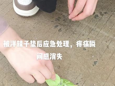 你有被洋辣子蛰过的经历吗? 被洋辣子蛰后,快速有效的消痛方式