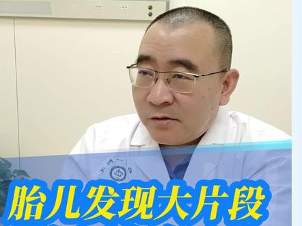 大片段的基因重复往往都是假阳性,做完验证再说 #郑大一附院遗传与产前诊断中心#医学科普#基因重复#dou来说健康