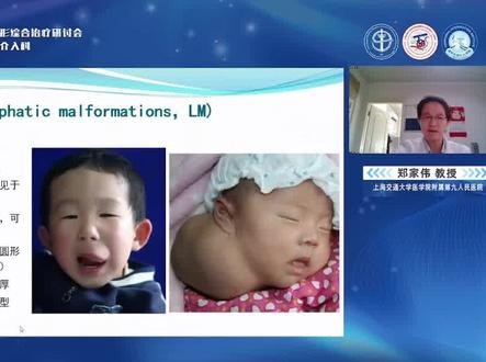 淋巴管畸形的临床特征以及形成原因
#医学科普 #健康科普 #淋巴管畸形 #血管瘤 #血管瘤宝宝