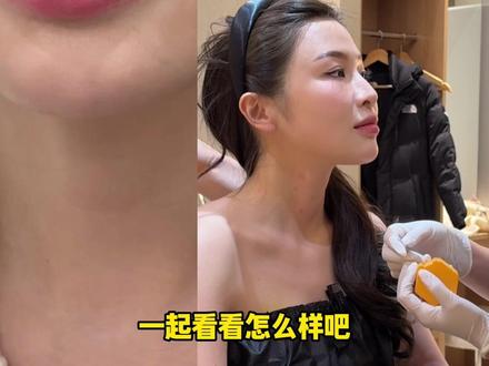 胶原水光居然能爆改颈纹?!
超微粒子自然支撑,防止恢复期凹凸不平的尴尬
#PGC丽肌希 #PPEUM丽芬聚 #日本变美 #赛帝妍 #胶原水光
