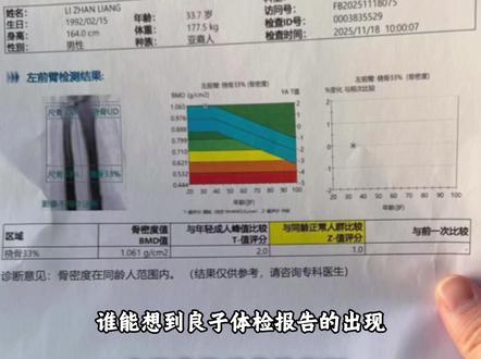 良子的体检报告出来后,一众网友却破防了 #良子 #体检 #离谱