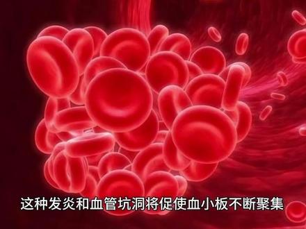 血小板的奥秘