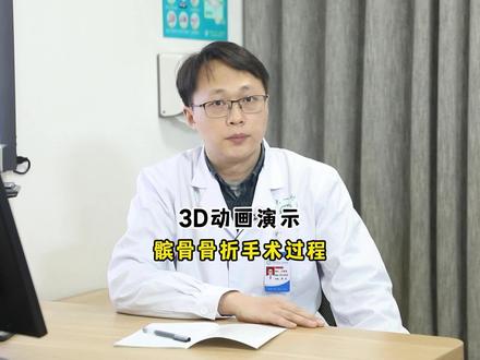 3D动画演示髌骨修复手shu#骨科手术 #骨科 #医学科普