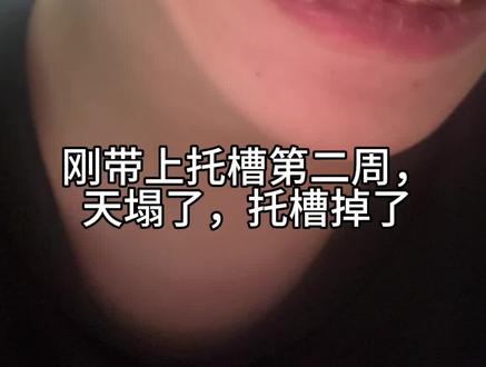 #正畸 #爱牙护牙 #牙齿
你们的托槽第一次掉是什么时候?