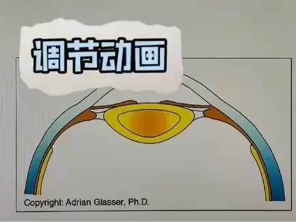 近视的原因你知道吗
学生配镜 成年人配镜 爱目视光