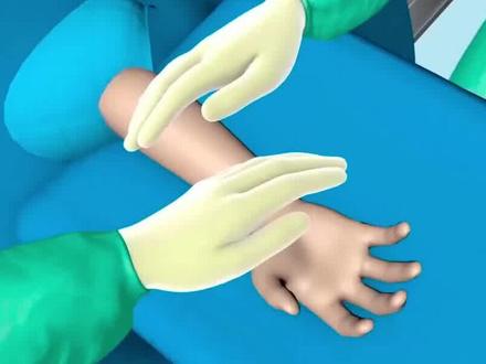指关节置换手术#医学科普 #健康科普 #3d动画