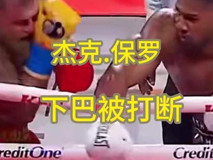 杰克.保罗下巴被击碎了 #拳击 #保罗 #约书亚 杰克保罗下巴被打断