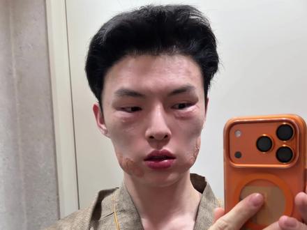 勇闯小韩变美微vlog #vlog #变美 #首尔旅行 #变美那些事