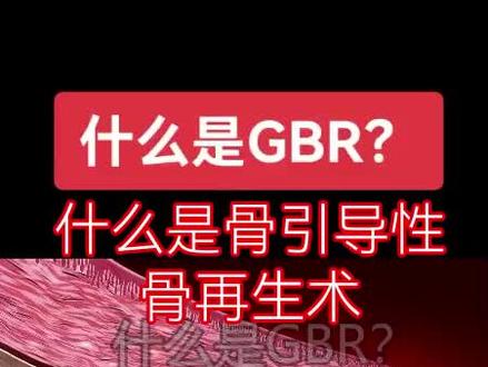 什么是骨引导性骨再生,看完视频你就明白了