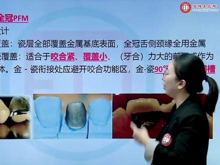 口腔执业含助理-口腔修复学:牙体缺损(烤瓷熔附金属PFM)#口腔#牙医 #口腔执业医师 #口腔执业助理医师考试